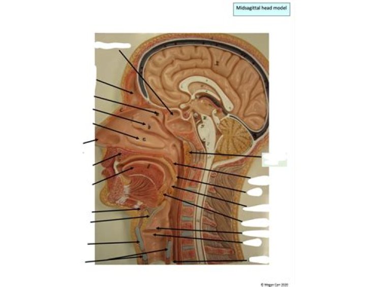 Midsagittal head model Quiz