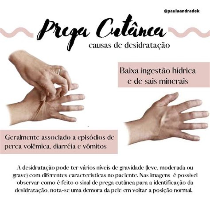 Movimento de afastamento das pregas vocais Quiz