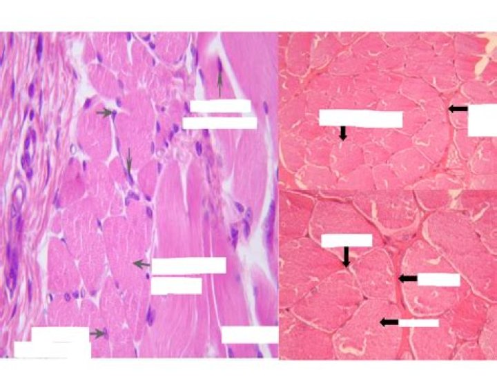 Muscle Cross Section Quiz