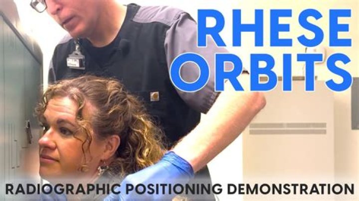 Orbits Rhese / Reverse Rhese Quiz