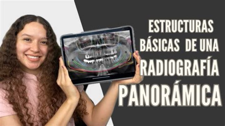 Radiografia Panorâmica - Estruturas Anatômicas Quiz