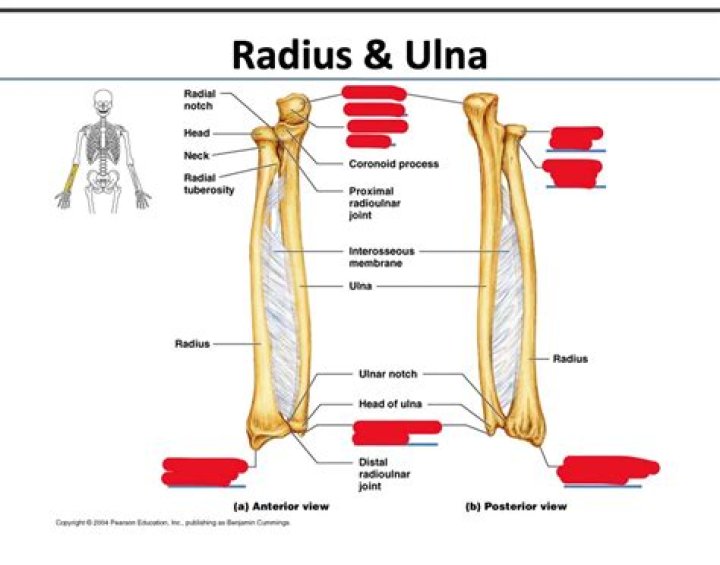 Radius and Ulna Quiz